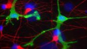 Dopaminergic Neurons and Microglia