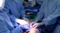 Doppler Probe Xenotransplantation Surgery