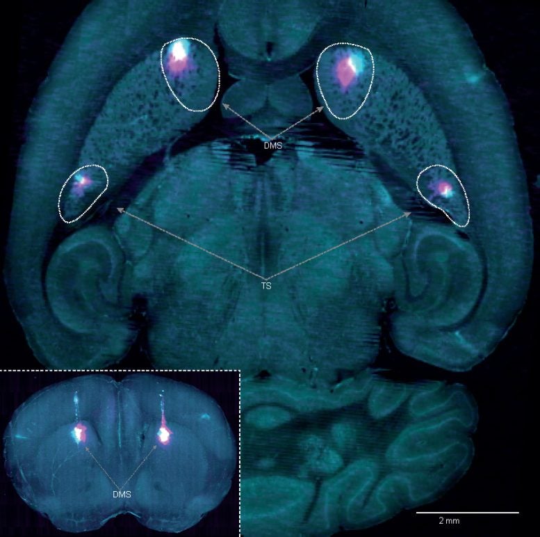 Dorsomedial Striatum and Tail of the Striatum