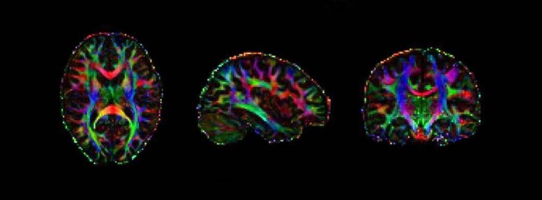 Dr. Rae Laboratory Brain Image
