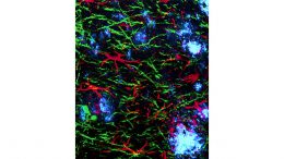 Drug Restores Cells and Memories in Alzheimer’s Mouse Models