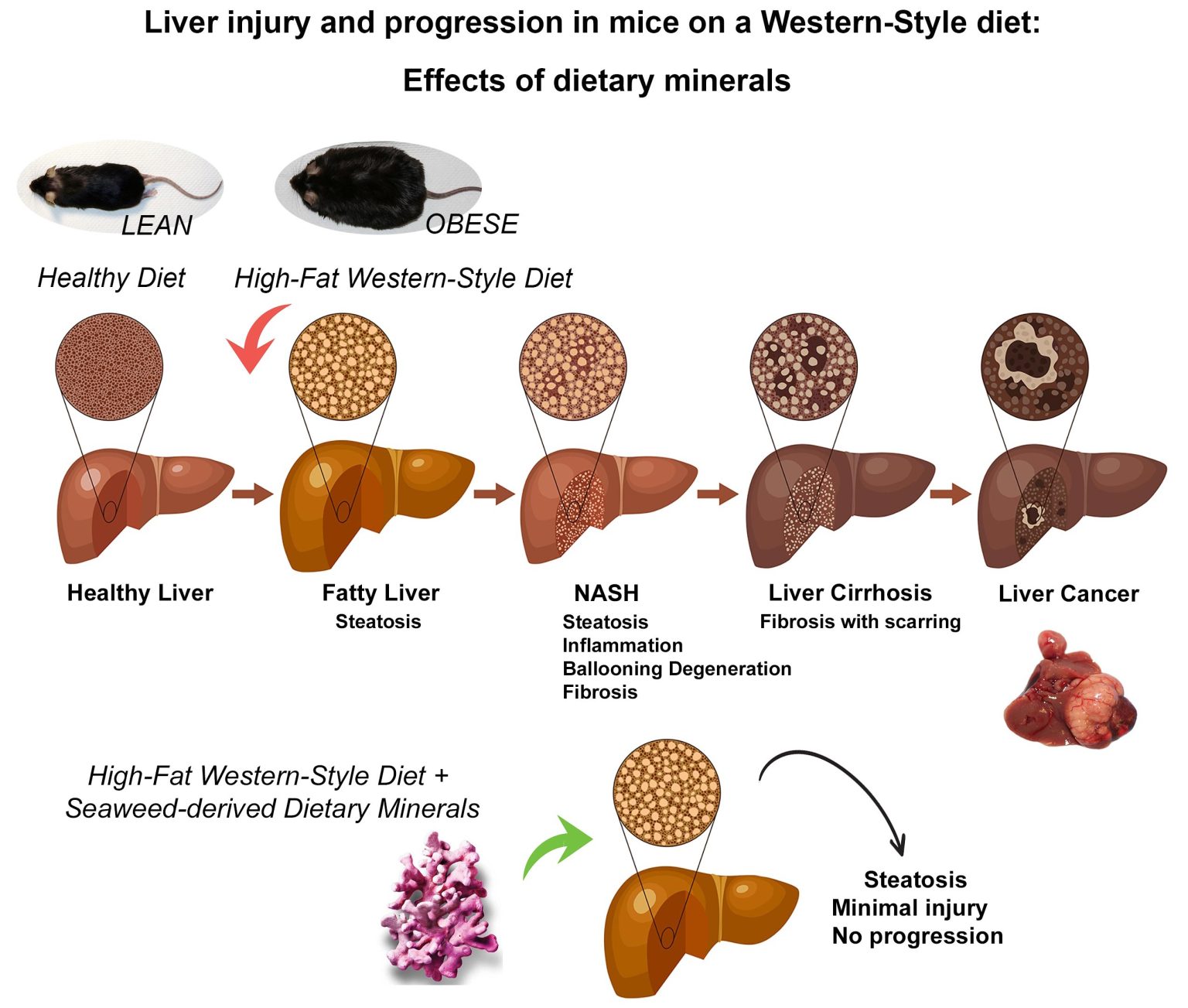 Mineral Dietary Supplement Could Stop Fatty Liver Disease Progression