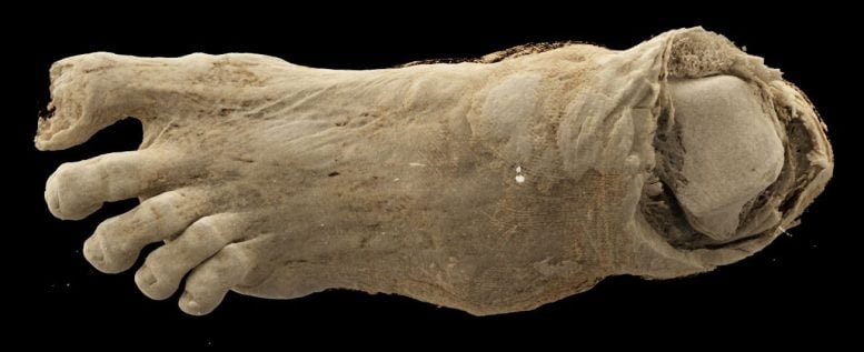 Egyptian Mummy Foot Examined at Semmelweis University