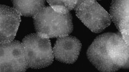Electron Micrograph Platinum Nanoparticles