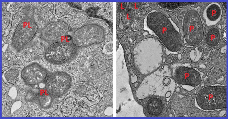 Electron Micrographs Show How Macrophages Expressing Girdin Neutralize Pathogens by Fusing Phagosomes with the Cell&rsquo;s Lysosomes