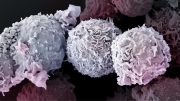 Electron Microscope Image of T Cells
