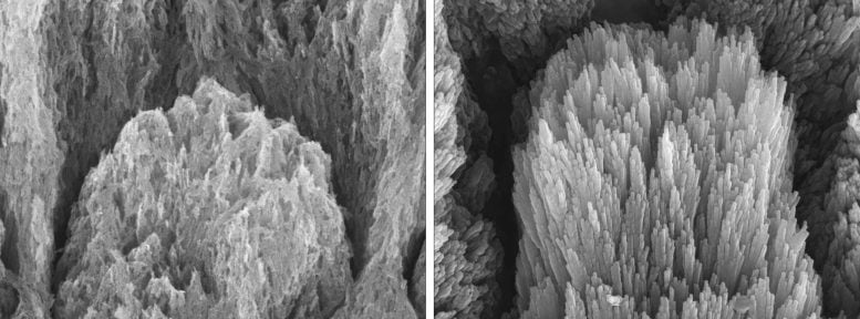 Electron Microscopy Images of a Tooth with Demineralized Enamel