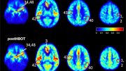 Elevated Blood Flow and Improved Oxygenation in Brain