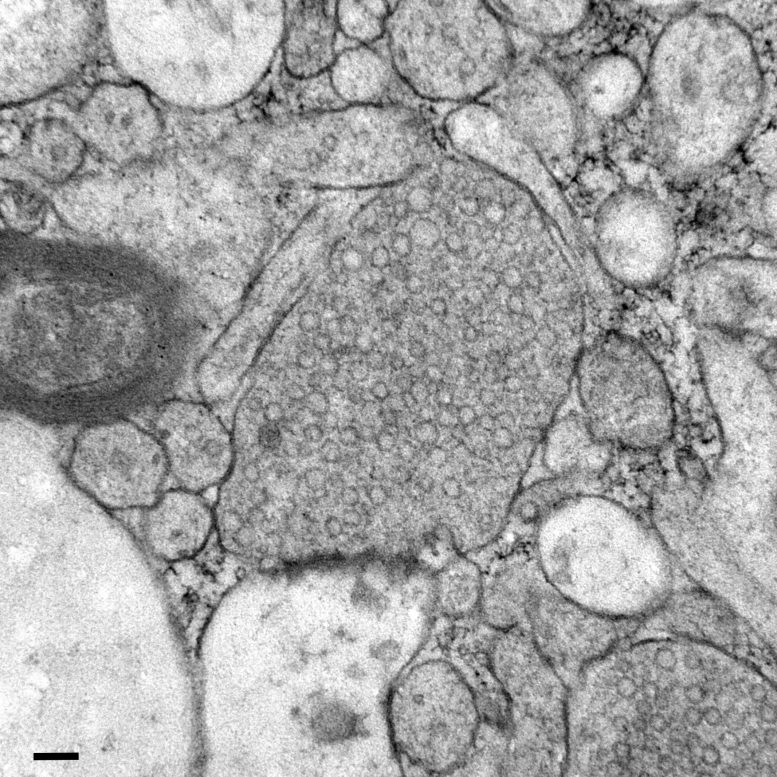 Endocytic Structure Human Brain Tissue