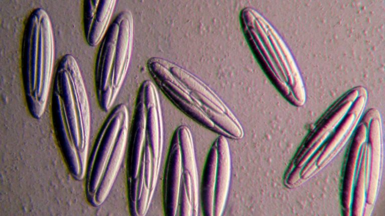 The Powerhouse Giant: Incredible Bacteria So Big, You Can See It ...
