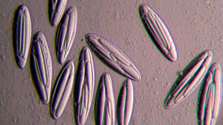 Epulopiscium Viviparus Bacteria