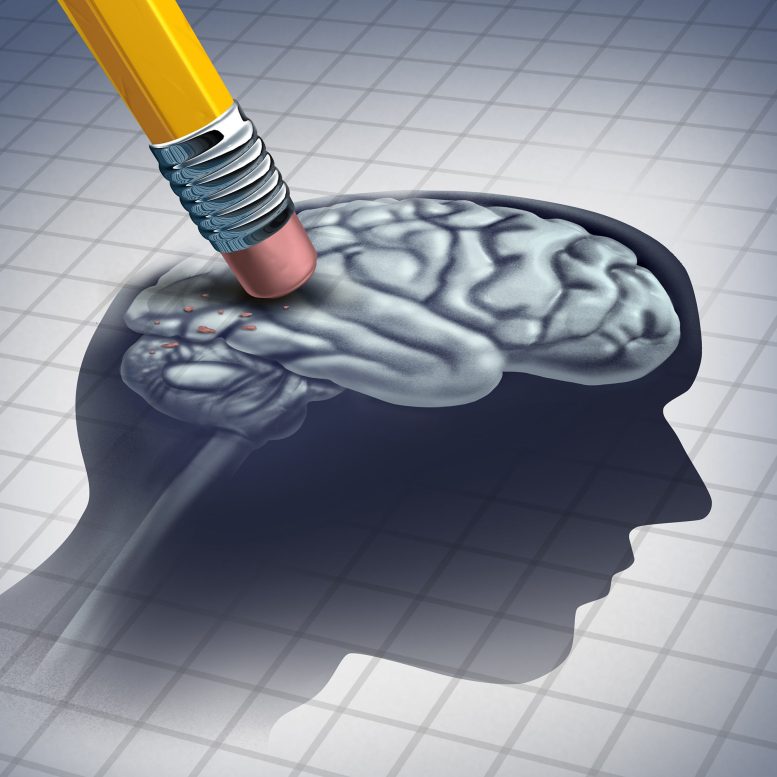 Erasing Brain Alzheimer's Dementia