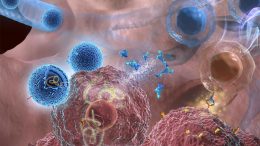 Exosomes Deliver IL 12 mRNA to Lung Cancer Cells