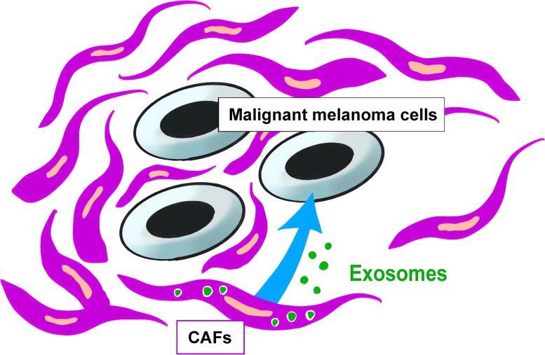 Exosomes From Cancer-Associated Fibroblasts May Suppress Malignant Melanoma