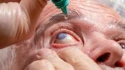 Eye Disease Glaucoma