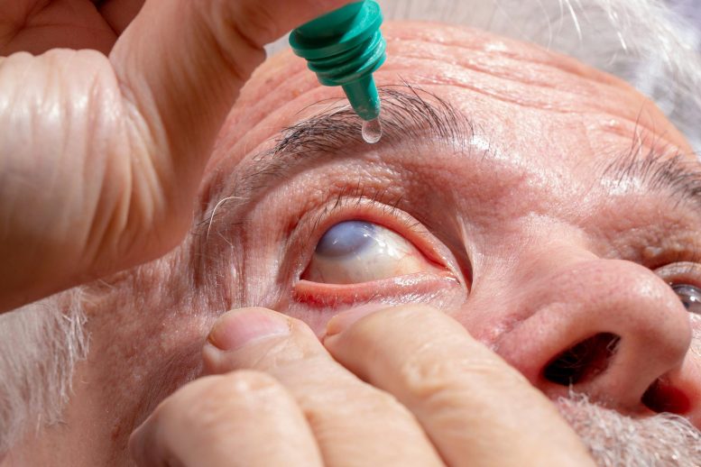 Glaucoma de doença ocular