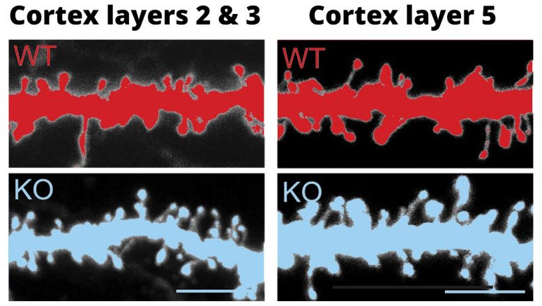 Knockout of FABP4 Changes the Morphology of Cortical Neurons