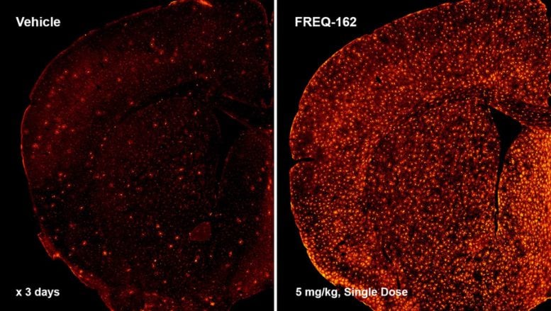FREQ 162, Progenitor Cells