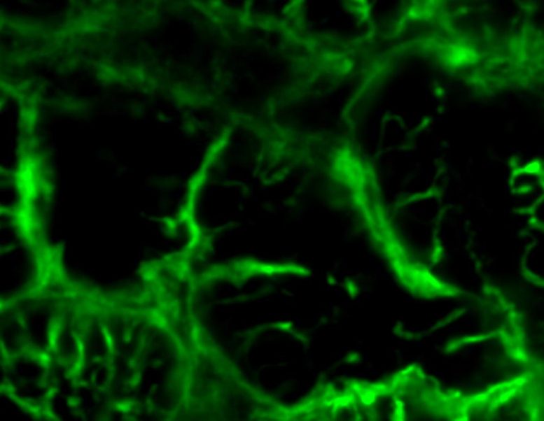 Failing Heart Cells
