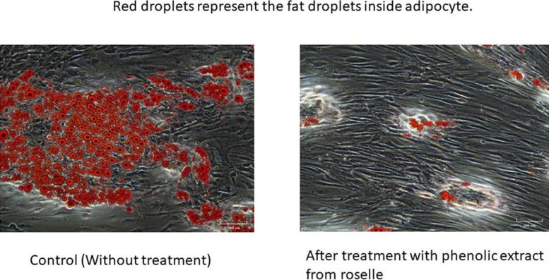 Fat Droplets in Adipocytes