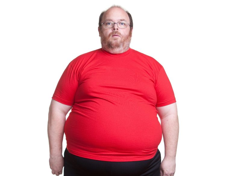 Fat Man Obesity