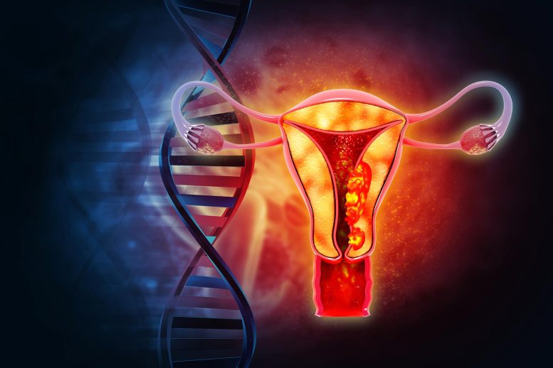 Female Reproductive System DNA Diseases Uterus Cancer Endometrial Malignant Tumor