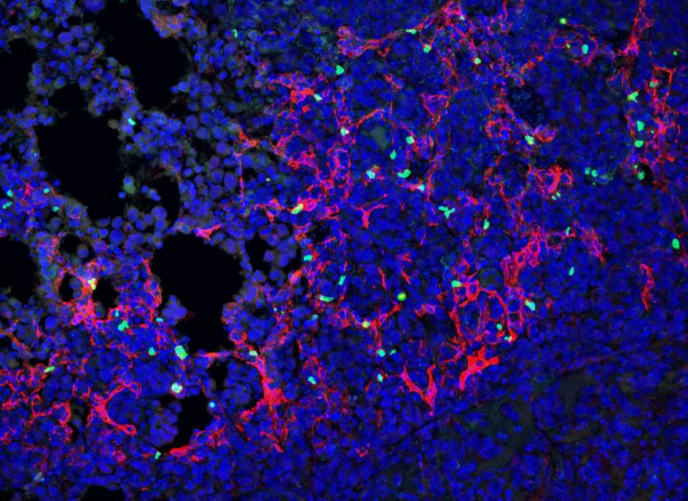 Fibroblasts and Regulatory T Cells in Lung Tumors