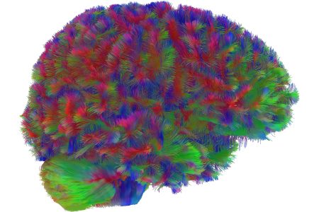 Your Brain Has Five Secret Ages, and One Lasts Most Of Your Life