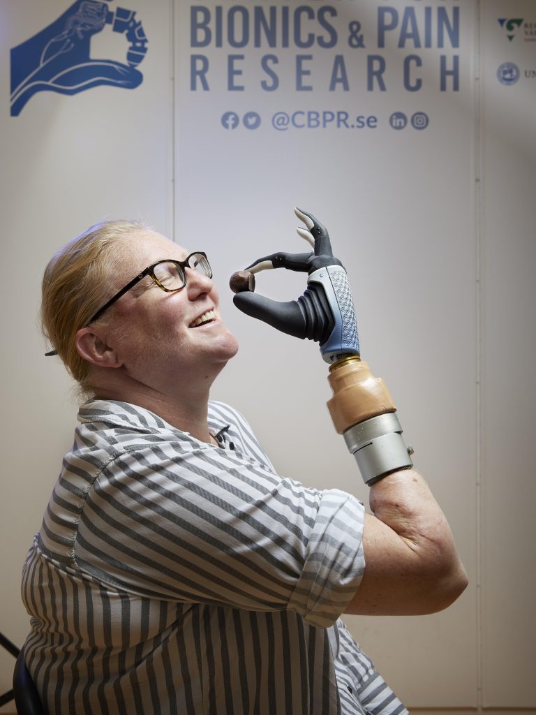 Revolutionizing Prosthetics – Scientists Develop Bionic Hand That