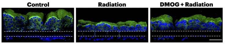 First Study of Radiation Exposure in Human Gut Organ Chip