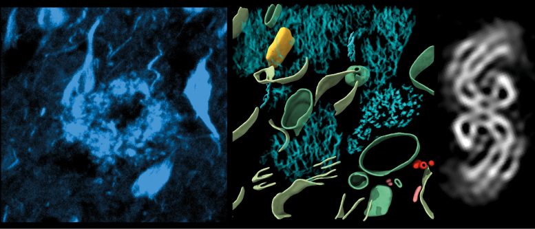 Fluorescencyjny obraz amyloidu, architektura 3D β amyloidu, w strukturach tkankowych Tau