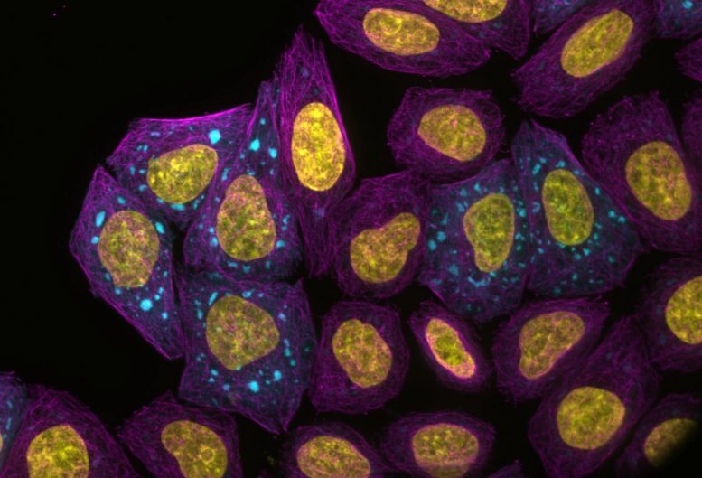 Fluorescence Microscopy Protein Condensates Forming