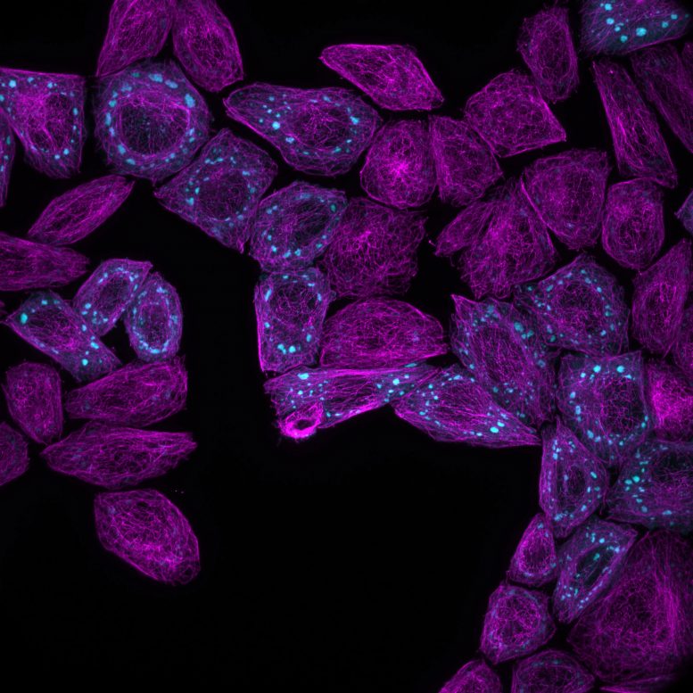 Canlı Hücrelerin İçinde Oluşan Floresan Mikroskobu Protein Yoğuşmaları