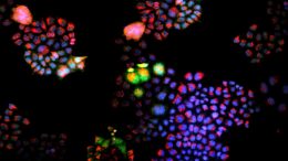 Fluorescence Microscopy Tumor Sample