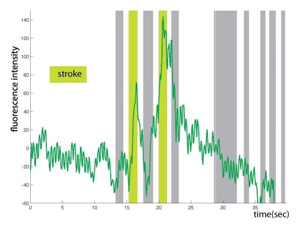 Fluorescence Stroke Stimulus Chart