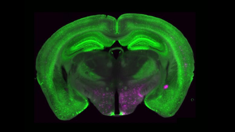 Fluorescent Brain Imaging NPY+ Neurons