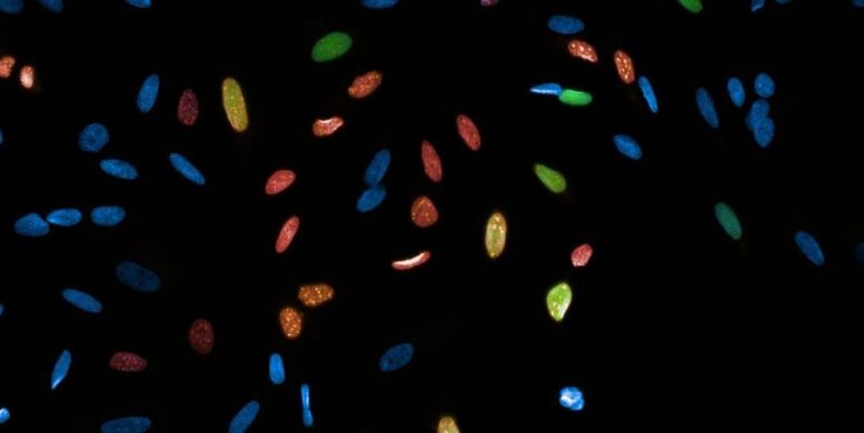 Fluorescent Cancer Cell Nuclei