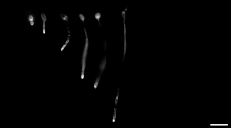 Fluorescent Image of Yeast Cells Growing Into Hyphae Over Time