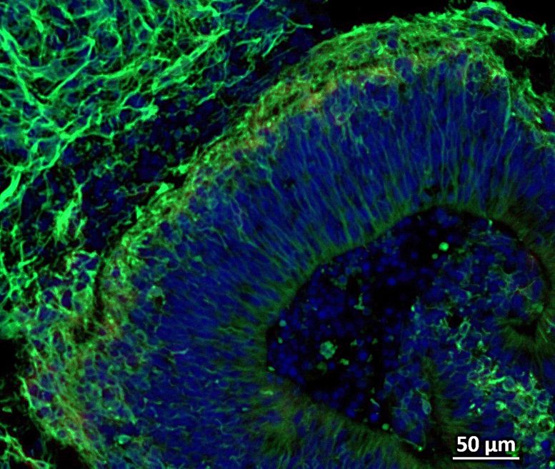 Fluorescent Image of a Brain Organoid Showing a Neuroepithelial Structure