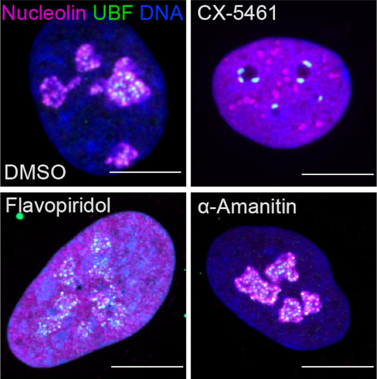 Fluorescent Images Showing Nucleolar Stress Induced by Drugs That Inhibit Transcriptional Enzymes