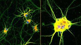 Fluorescent Images of Enhanced Human Neurons