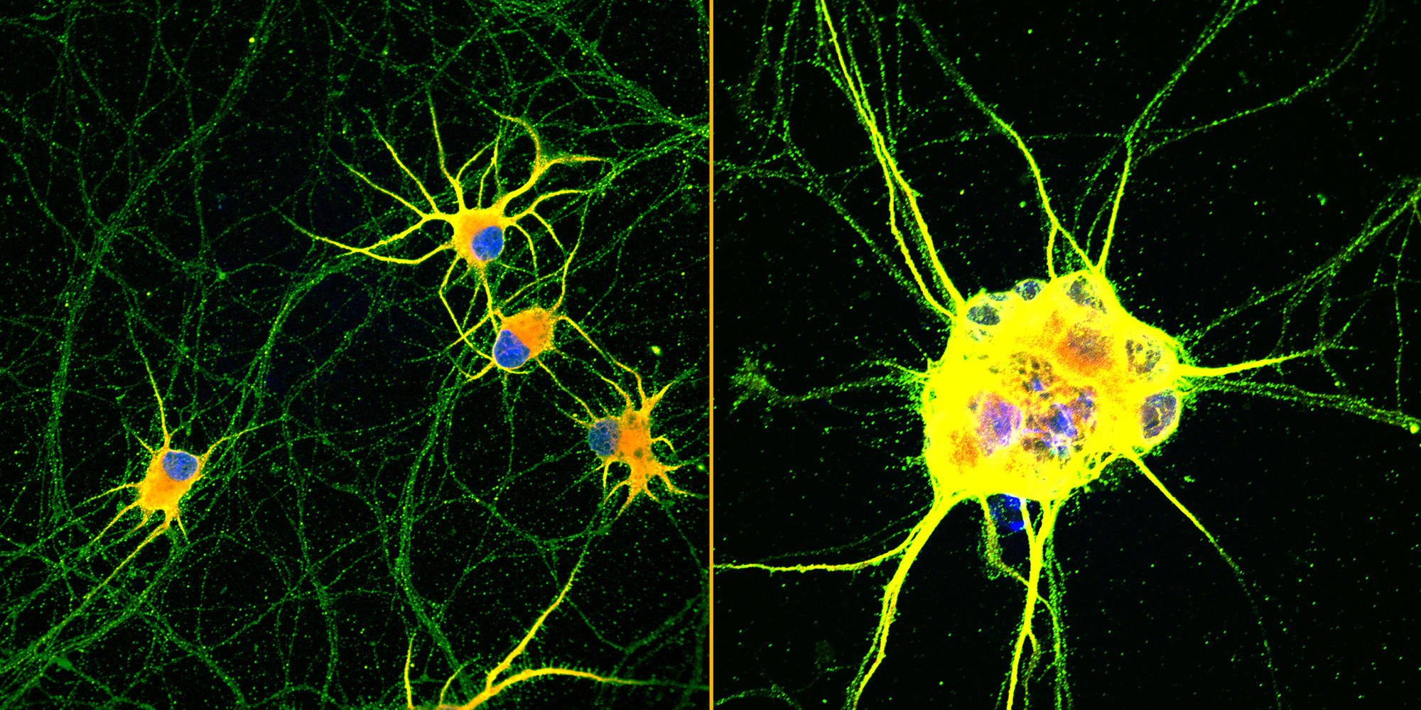 Fluoreszenzbilder von verbesserten menschlichen Neuronen