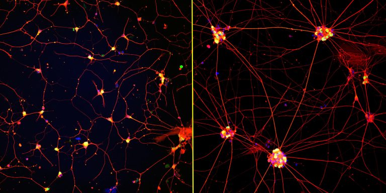 Mature “Lab Grown” Neurons Hold Promise for Neurodegenerative Diseases ...