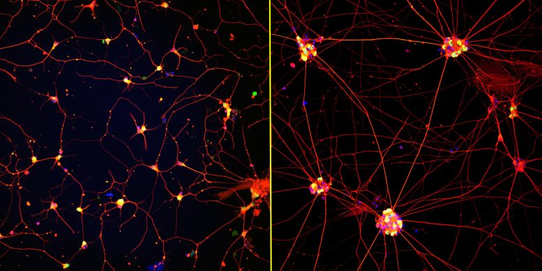 Fluorescent Images of Human Neurons