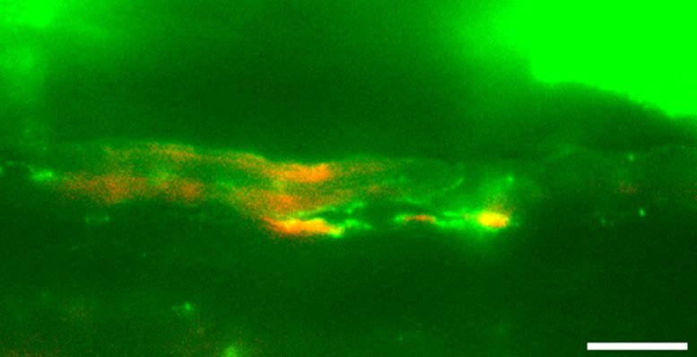 Fluorescent Tracer Moving Through Lymphatic Pathway