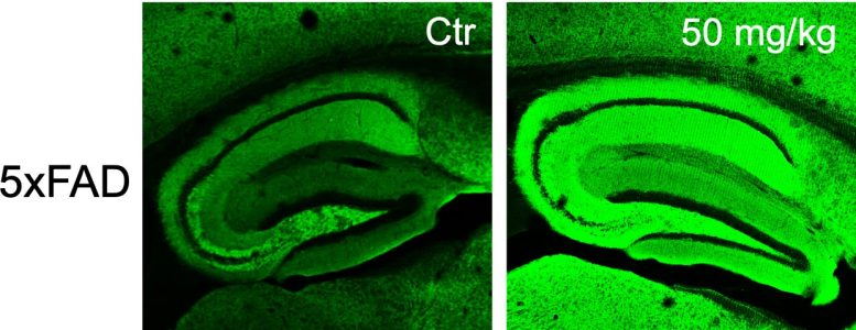 Fluorescently Stained Mouse Brains Expressing Genes That Cause Alzheimer&rsquo;s Disease