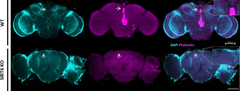 Fly's Brain Under a Microscope