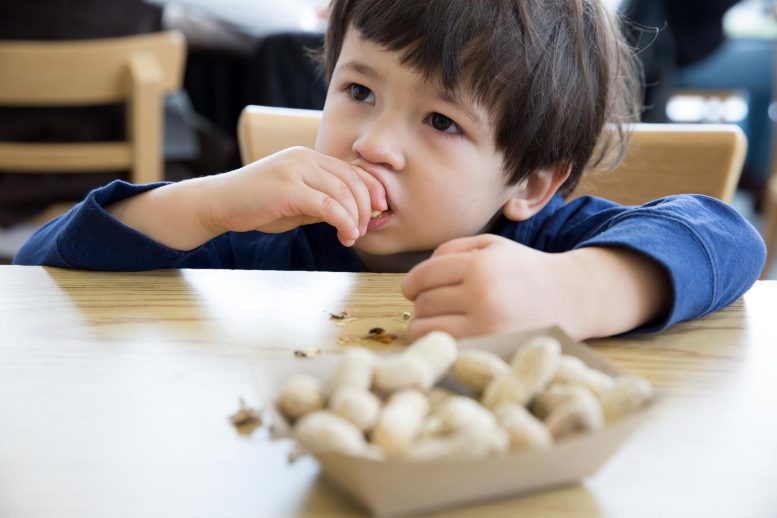 Food Allergies Child Eating Peanuts