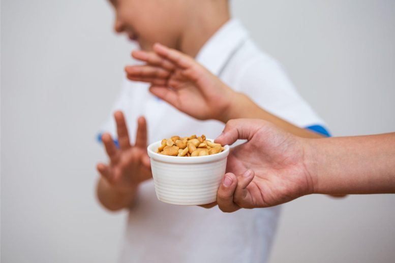 Food Allergy Peanuts Child