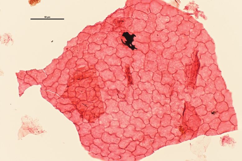 Fossilized Leaf Cuticle From Dense Forest
